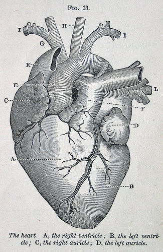 New Subject: Atrial Fibrillation; Or, A Heart in Chaos